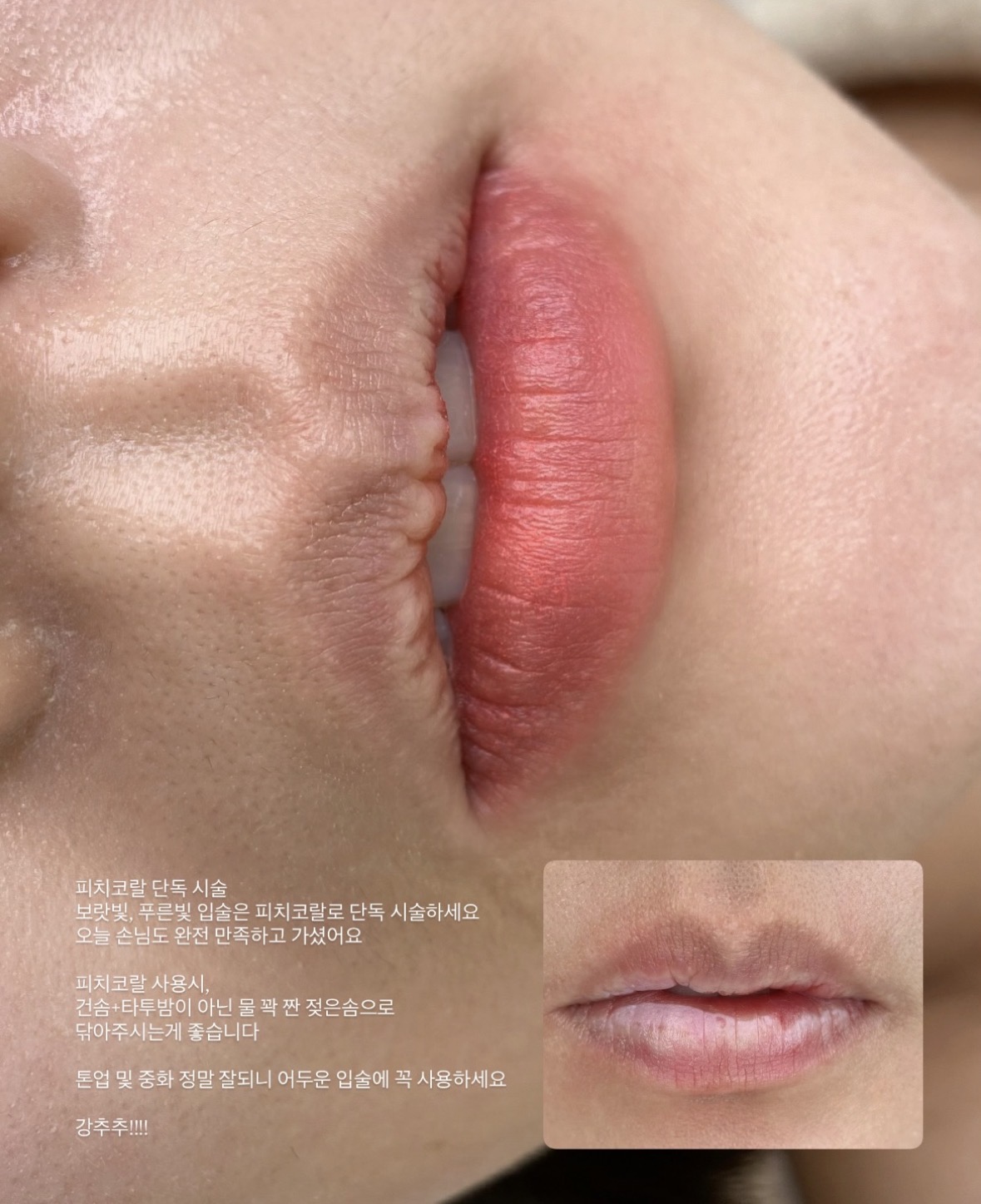 霧唇